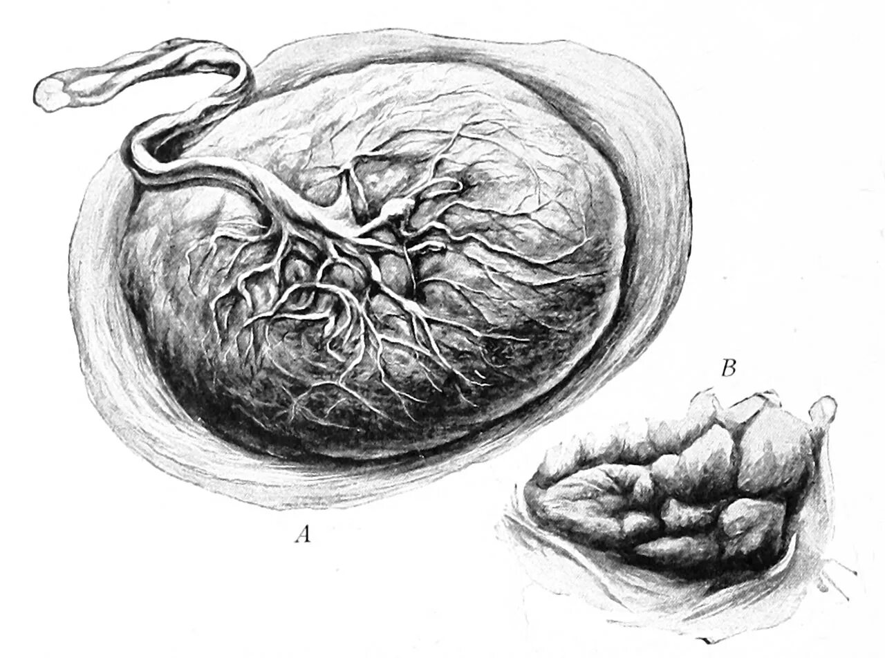 Плод в полости матки. Эмбрион плацента пуповина. Плацента и пуповина анатомия.