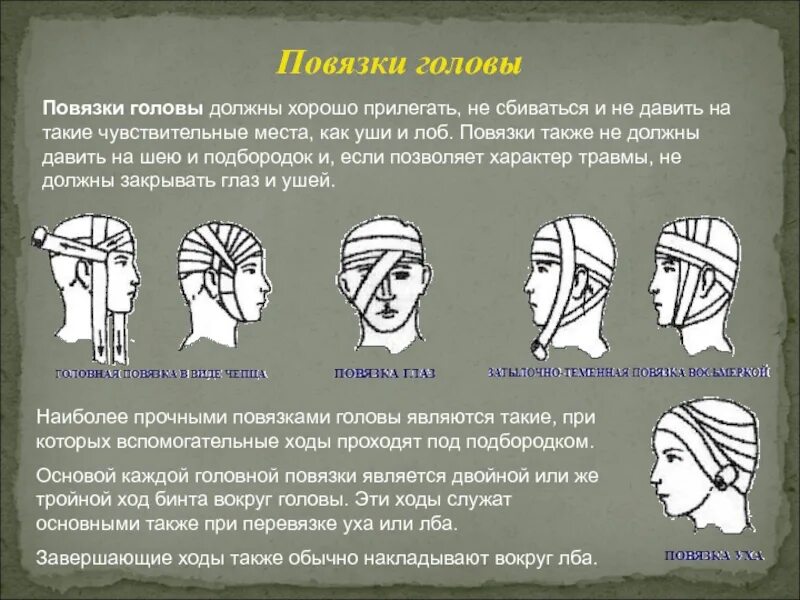 Какая повязка при травме головы. Повязка при черепно-мозговой травме. наложение повязки при черепно-мозговой травме. наложение повязки при ранении головы.