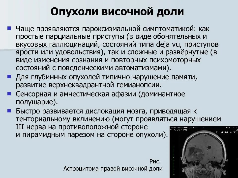 Рак мозга сколько стадий. Опухоли ГМ височной доли. Объемные образования височной доли. Опухоль височной доли головного мозга симптомы. Опухоль правой височной доли.