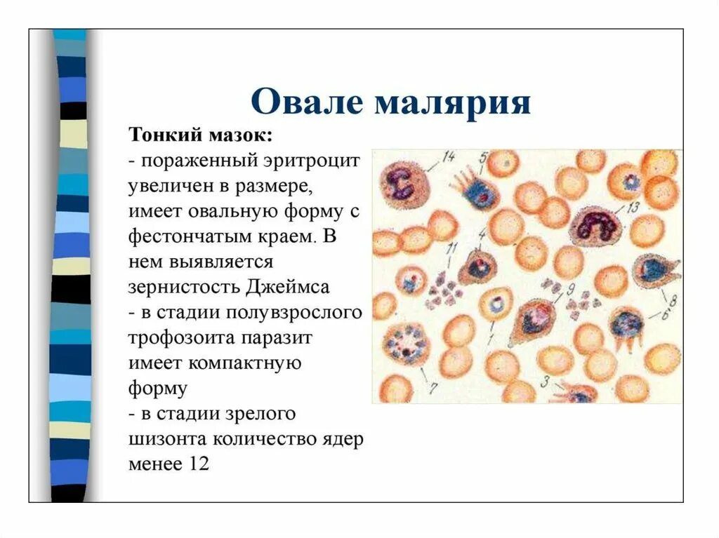 Первичная малярия это. Малярия шизонт. Четырехдневная малярия мазок крови. Мазок крови больного малярией.