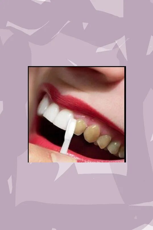 Как сделать зубы оно. Как сделать зубы белее. как сделать чтобы зубы были белыми.