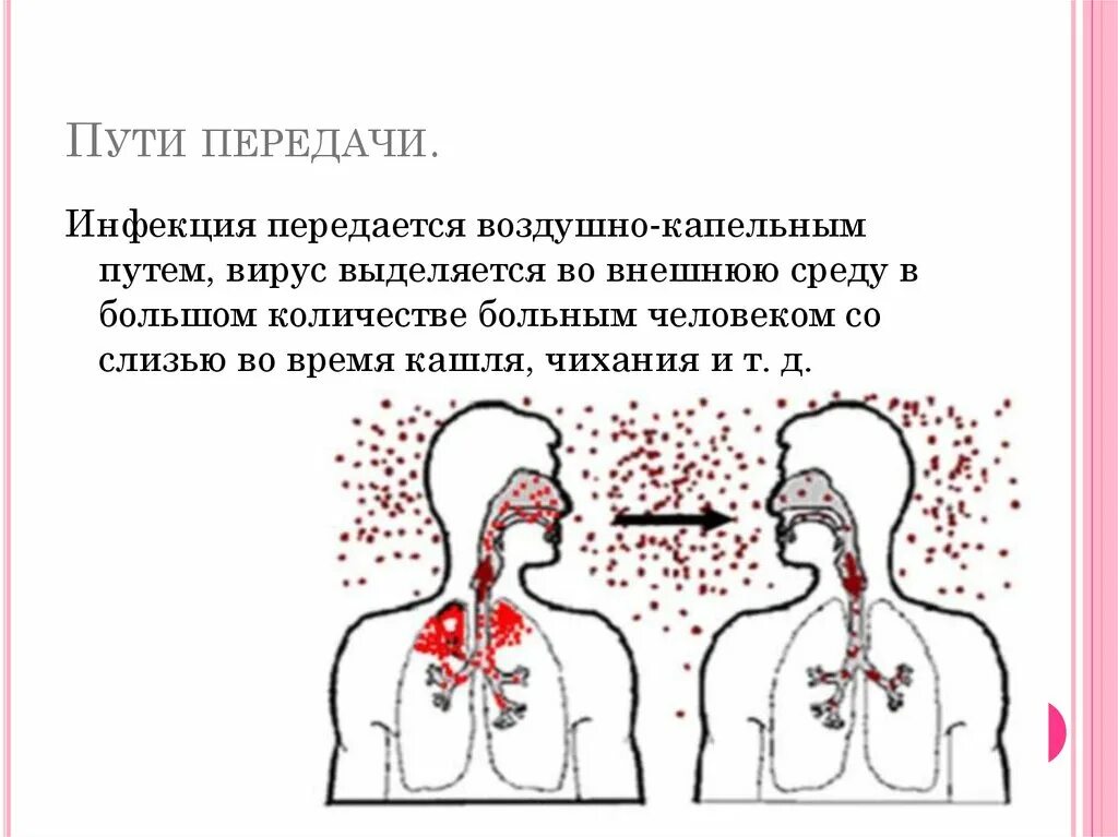 Корь и туберкулез