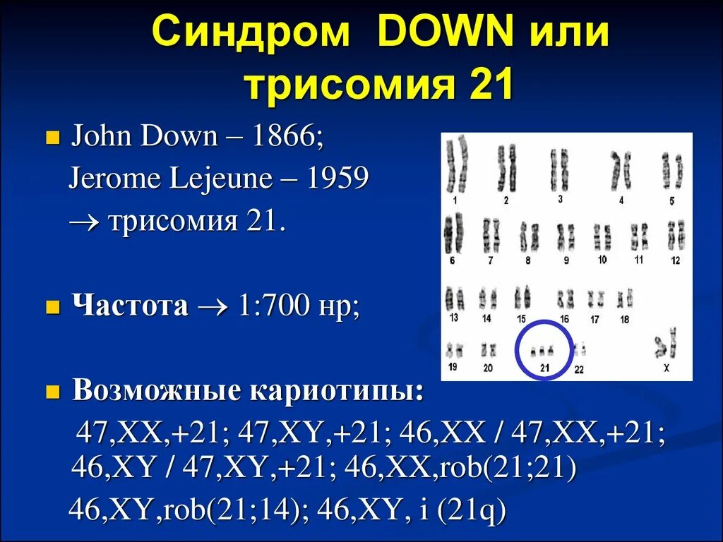 Синдром дауна генотип и фенотип. Кариотип больного с синдромом дауна. кариотип синдрома дауна формула. болезнь дауна кариотип. формула кариотипа при синдроме дауна.