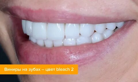 Цвет блич 4