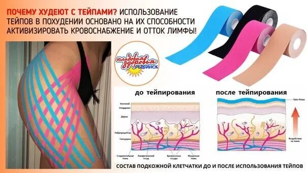 Тейпирование живота для подтяжки схема. Тейпирование боков схема. схемы тейпирования для похудения живота. схемы тейпирования для похудения. схемы тейпирование при варикозе.