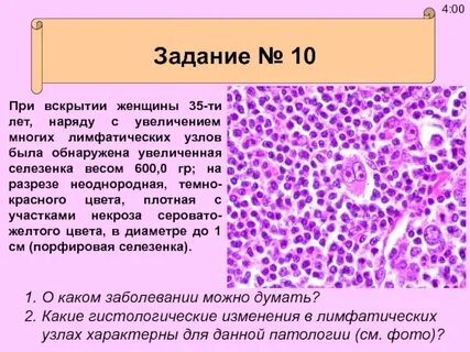 Масса селезенки