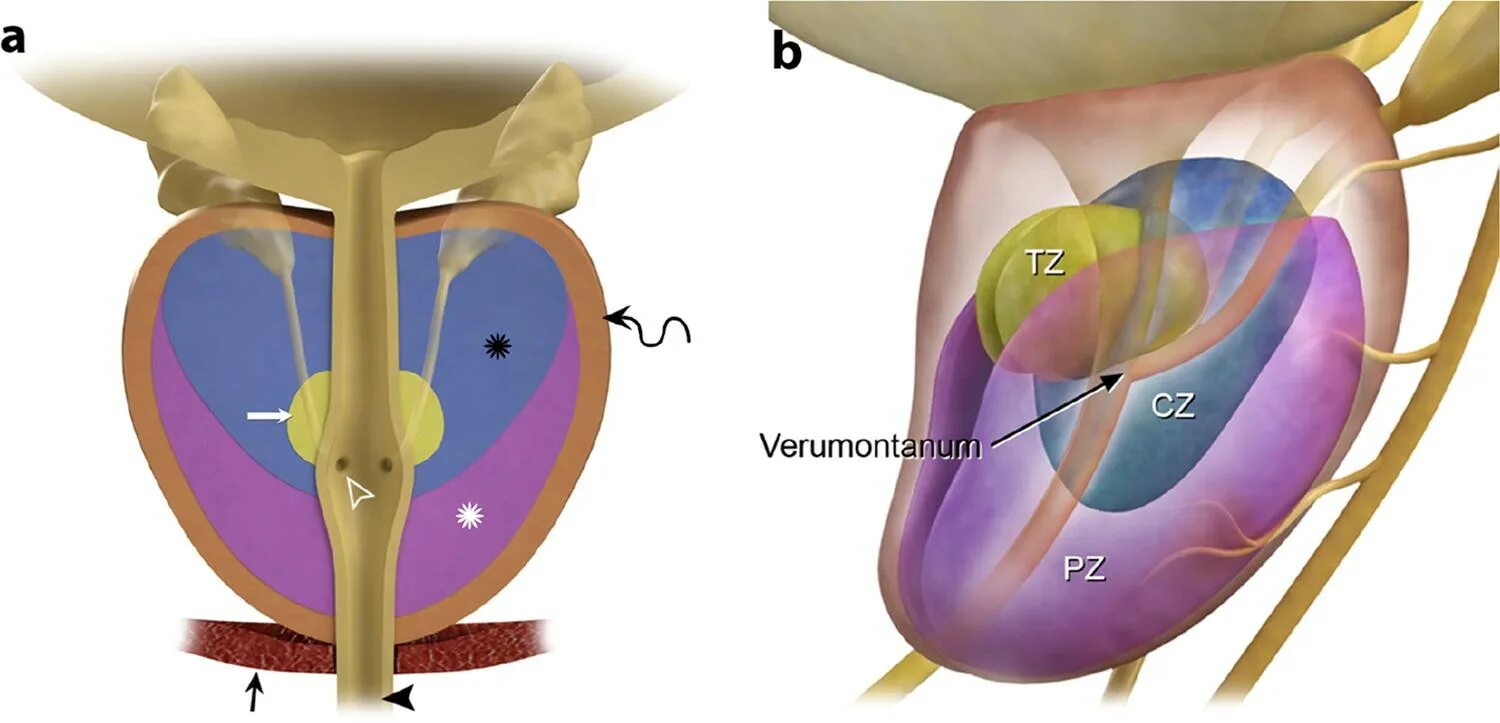 Предстательная железа капсула. DHEA prostate. Зеншин капсула Дории серса. Prostate Zonal Anatomy.