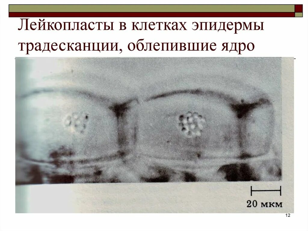 Клетка эпидермы листа традесканции виргинской. Лейкопласты в клетках эпидермиса. Лейкопласты в клетках эпидермиса (кожицы) листа традесканции. Лейкопласты в клетках эпидермиса листа традесканции. Кожица листа традесканции