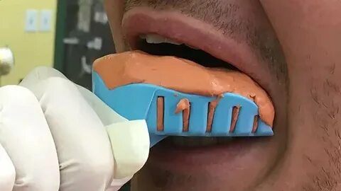 Как делаются зубы