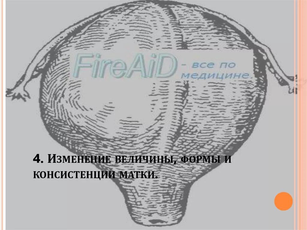 Формы матки. Изменение величины формы и консистенции матки. матки форма, консистенция. изменение консистенции матки при беременности. пискачека гентера губарева.