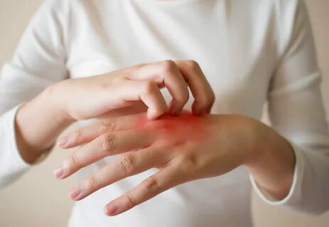 Как лечить красные руки изнутри и снаружи? 