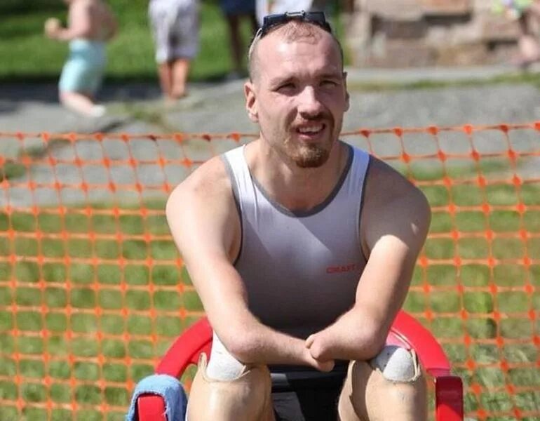 Парни инвалиды после войны. Русский без ног. Инвалиды без рук и ног после войны. Протезы ног для бега. Оскар писториус.