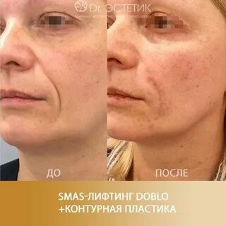 Смас интимной зоны