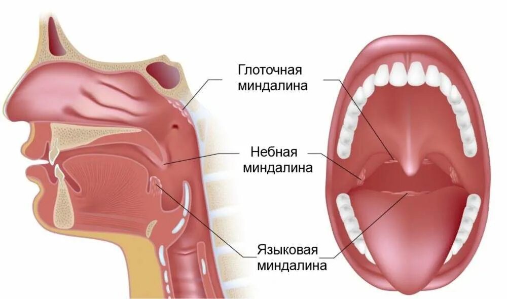 Как вылечить носоглотку