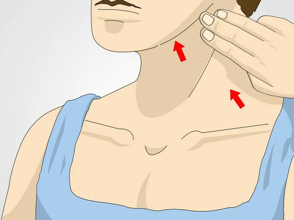 болит шея и ключица слева. синдром титце ключицы симптомы. боль в левом плече и ключице. операция плечелопаточный периартрит. болит подключичная ямка.