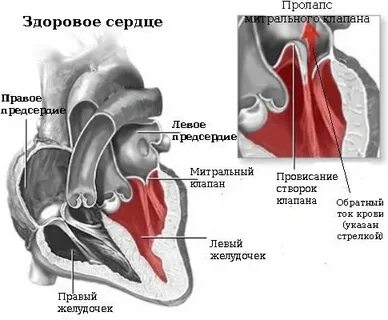 Пролапс задней стенки