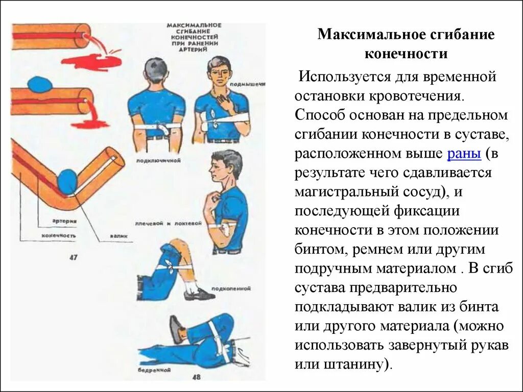 Остановка кровотечения максимальным сгибанием конечности алгоритм. Максимальное сгибание конечности осложнения. Максимальное сгибание конечности для остановки кровотечения. Максимальное сгибание конечности в суставе.