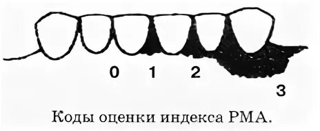 Индекс десна. Папиллярно-маргинально-альвеолярный индекс (PMA). Индекс ПМА В стоматологии. Индекс PMA В модификации Парма.