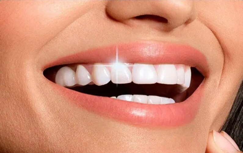 Невидимые брекеты элайнеры. Зубы в минске. Лазерное удаление зубов фото. Виниры цельнокерамические emax. Невидимые брекеты элайнеры.