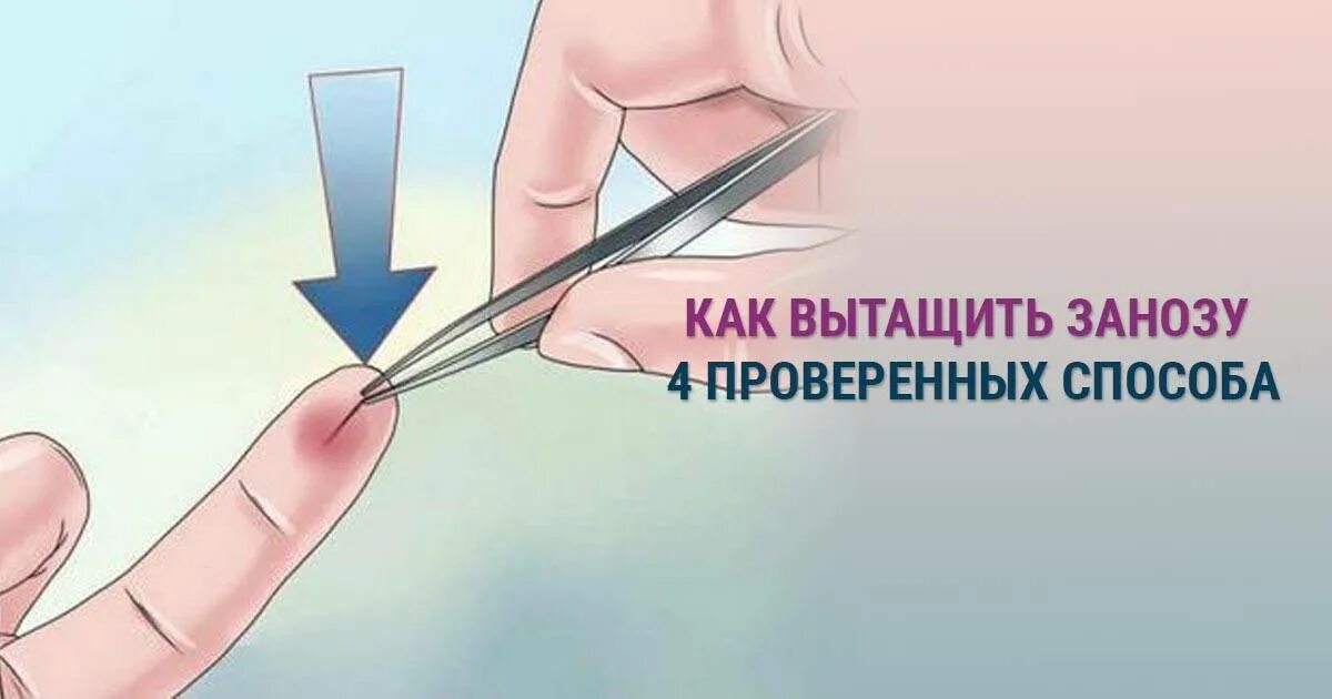 Как достать занозу из пятки. Как можно вытащить занозу. как вытащить занозу способы. как безболезненно вытащить занозу из пальца у ребенка.