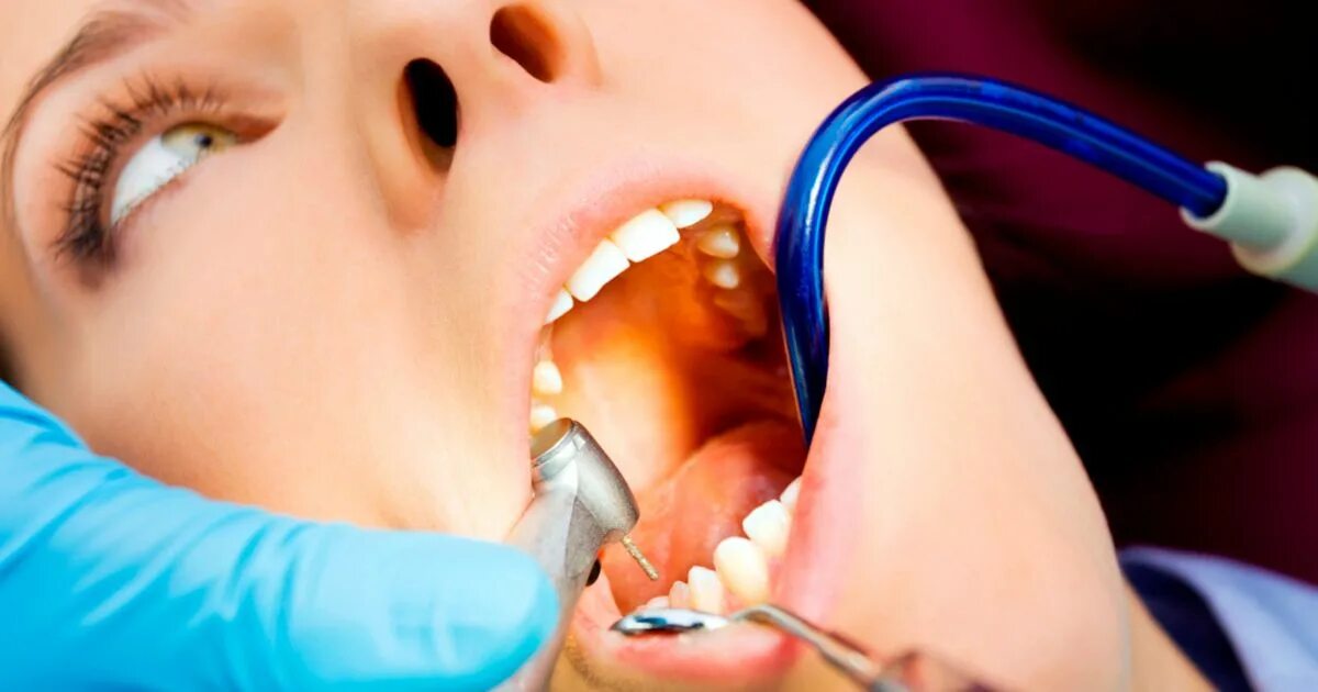 Дети у зубного. Гель для крепления зубных протезов. Куда кладут зубы. Элайнеры invisalign. Зубы улыбка стоматология.