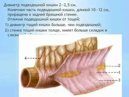 Левая подвздошная кишка