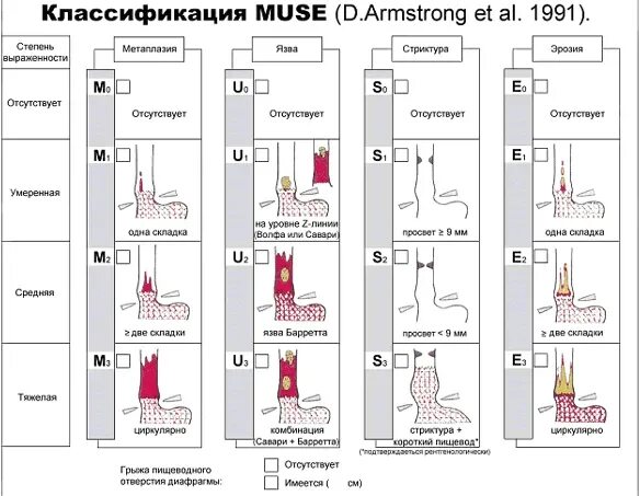 Лос-Анджелесская классификация рефлюкс-эзофагита. Лос-Анджелесская классификация рефлюкс-эзофагита эндоскопическая. Парижская классификация эзофагитов. Лос анджелесская классификация эзофагитов