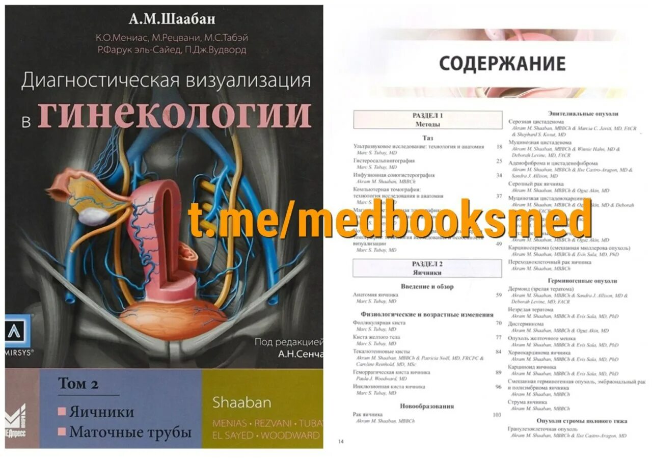 I триместр отзывы. узи в гинекологии книга. диагностическая визуализация купить. узи в акушерстве. диагностическая визуализация в акушерстве 2 триместр.