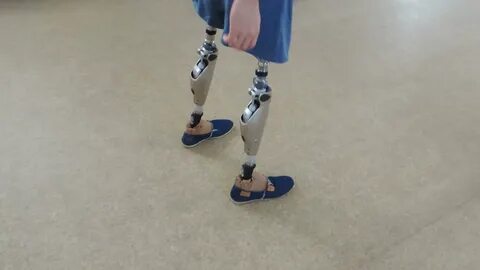 Four legs