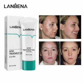Skin care gel
