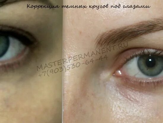 камуфляж под глаза. перманент консилер до и после. перманентный макияж темных кругов под глазами. перманентный макияж кругов под глазами. перманент консилер.