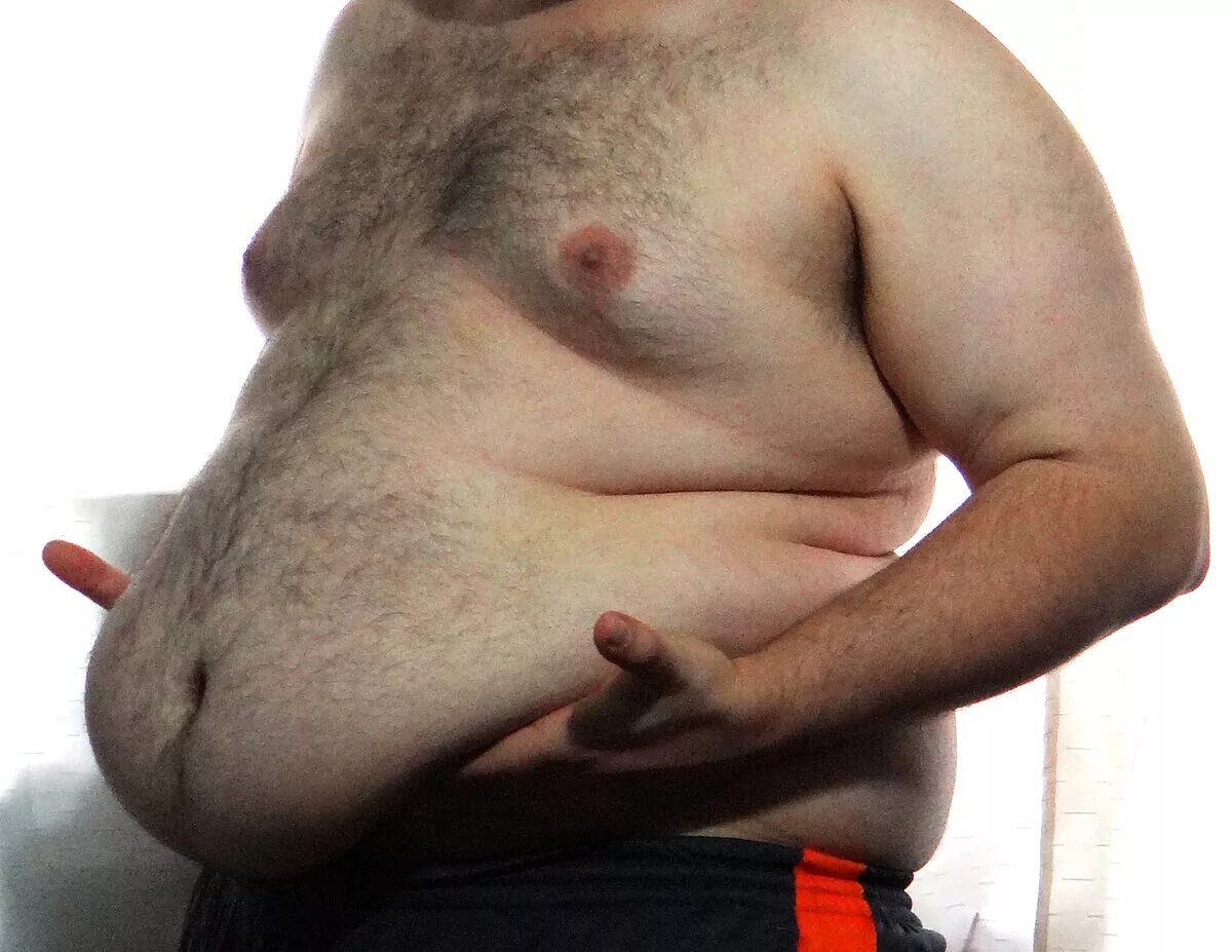 Мужчины с большими животами. Морбидное ожирение имт. Большой живот у мужчин причины. Человек с большим животом. Большой живот у мужчин причины.