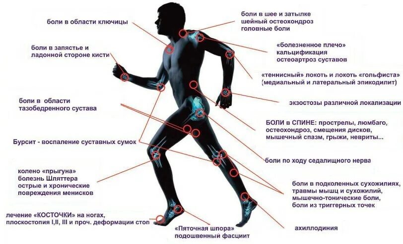 Боли после ударно волновой терапии. Ударно волновая терапия механизм воздействия. Аппараты ударно волновой терапии показания. Ударно-волновая терапия плечевого сустава показания. УВТ ударно волновая терапия.