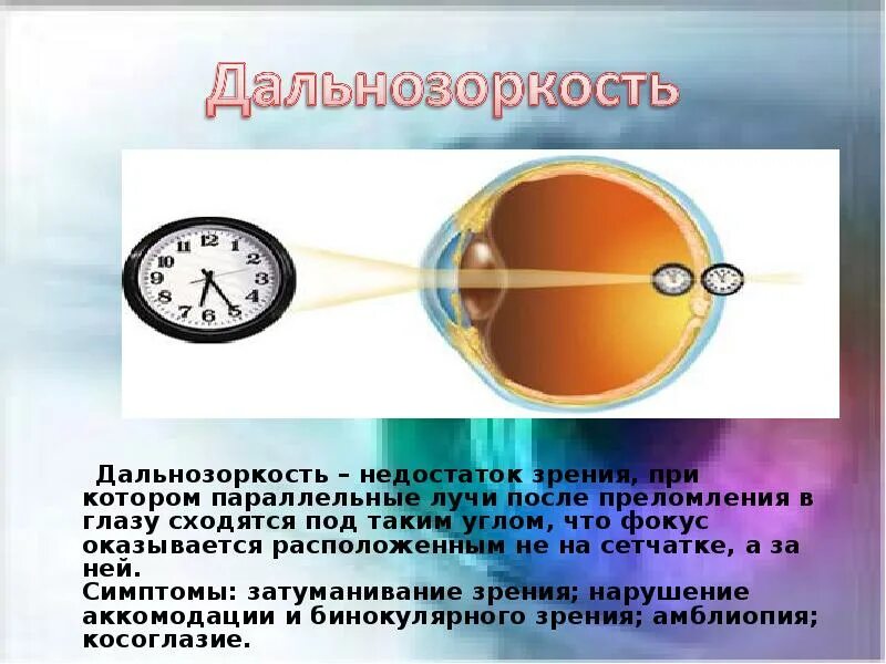 Дефекты зрения ответы. Дальнозоркость. Зрение при дальнозоркости. Это недостаток зрения при котором параллельные лучи. Дальнозоркость +2.