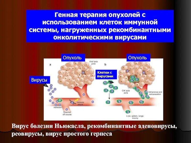 Онколитическая вирусная генная терапия. Механизм действия онколитических вирусов. Вирусы опухоли