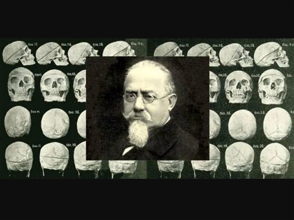 Преступник по чезаре ломброзо. Ломброзо теория внешность преступника. Антропологическая теория ломброзо. Чезаре ломброзо теория. Чезаре ломброзо прирожденного преступника.