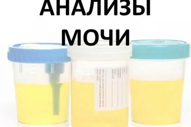 Анализ мочи. Надпись моча. Анализ мочи картинки. Лабораторные исследования мочи.