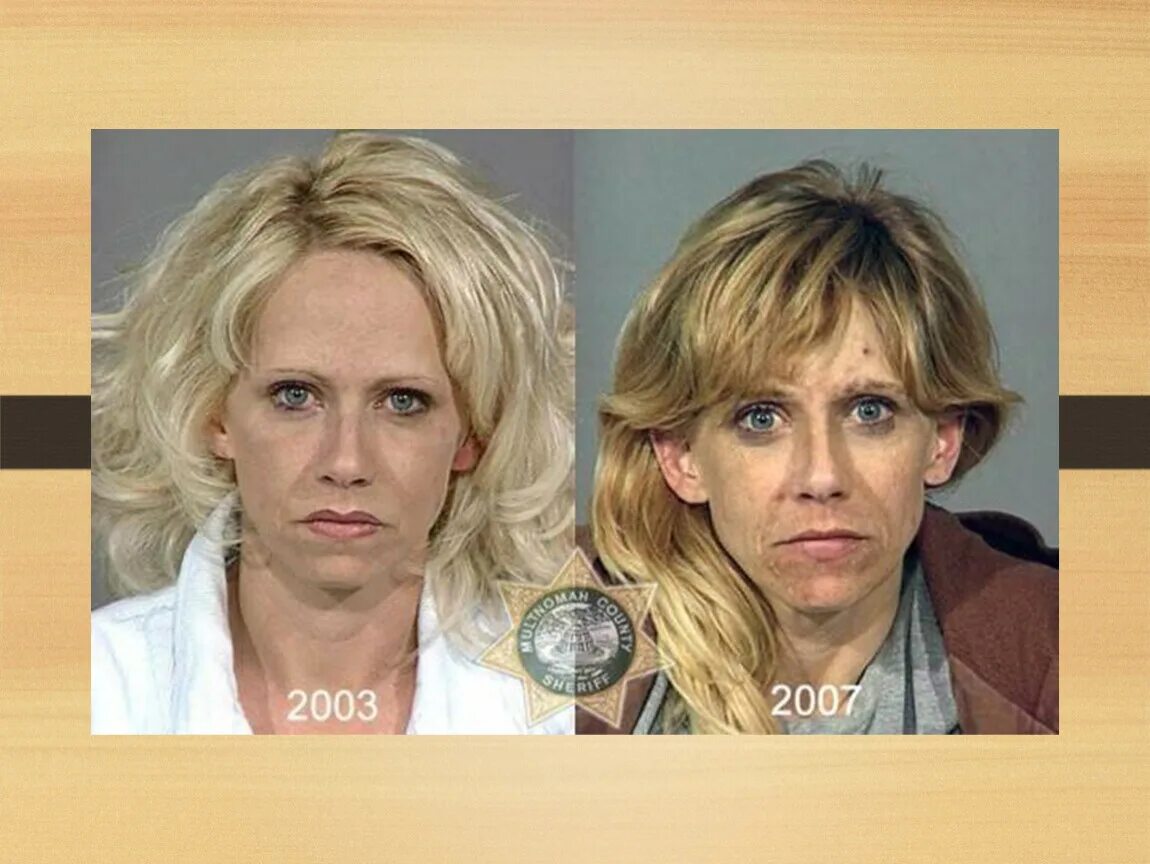 Курящие до и после. Люди до и посленаротиков. До и после употребления наркотиков. Что с людьми после употребления наркотиков до и после.