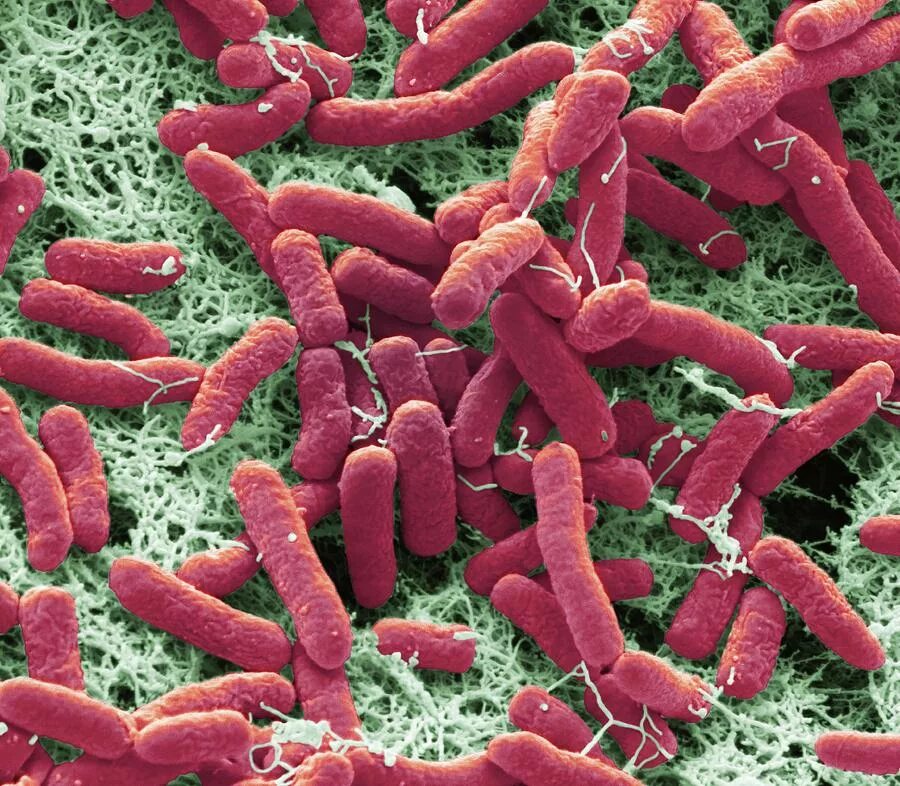 Бактерии Pseudomonas. Бактерия Pseudomonas aeruginosa. Микроорганизмы рода Pseudomonas. Псевдомонас кореенсис. Бактерия синегнойная палочка