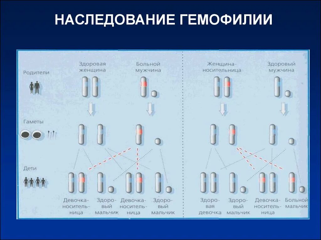 Гемофилия кариотип больных. Генотип и кариотип гемофилии. Наследование гемофилии. Схема наследования гемофилии. Носители гемофилии женщины