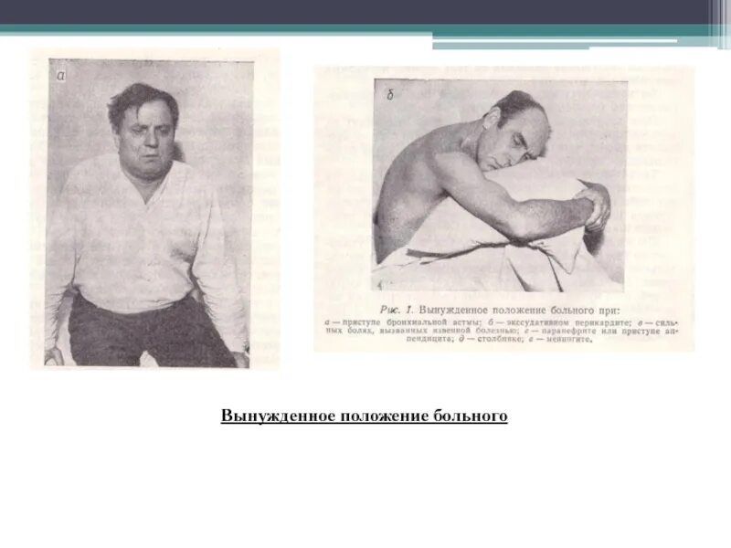 Положение пациента при осмотре. Положение больного. вынужденное положение больного. вынужденное положение больного при перикардите. положение больного при выпотном перикардите.