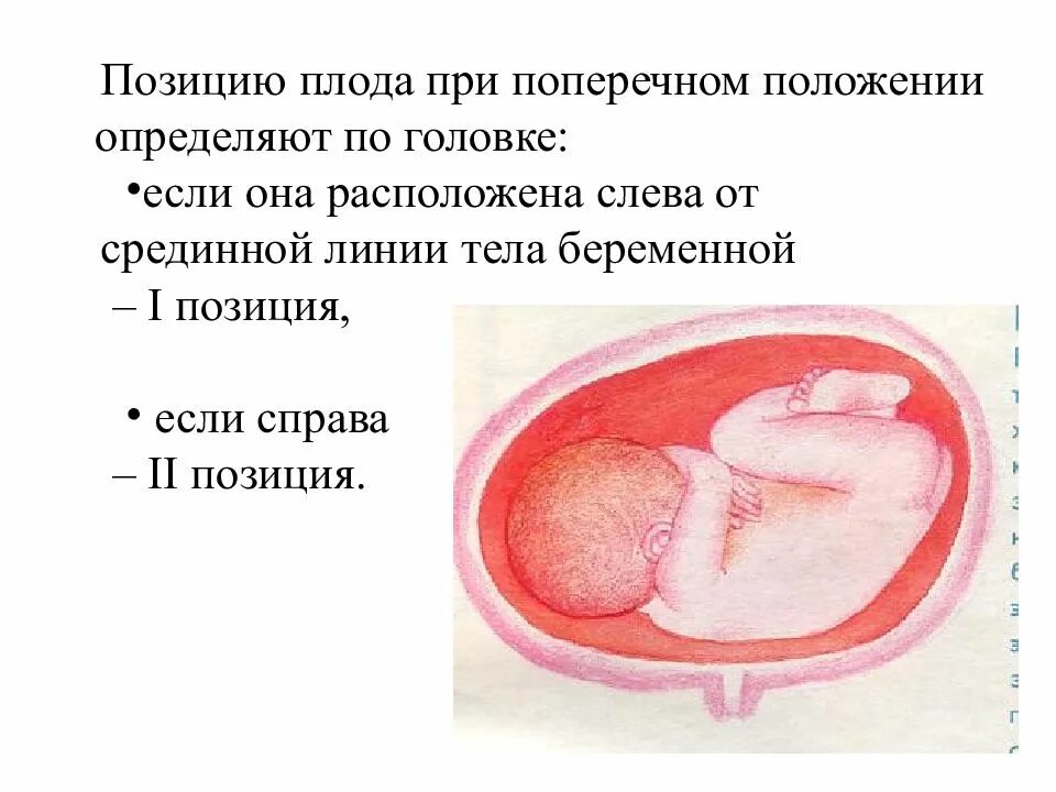 Запущенное положение плода. Поперечное положение плода. Продольное и поперечное положение плода. Поперечная позиция плода. Поперечное положение плода при беременности.