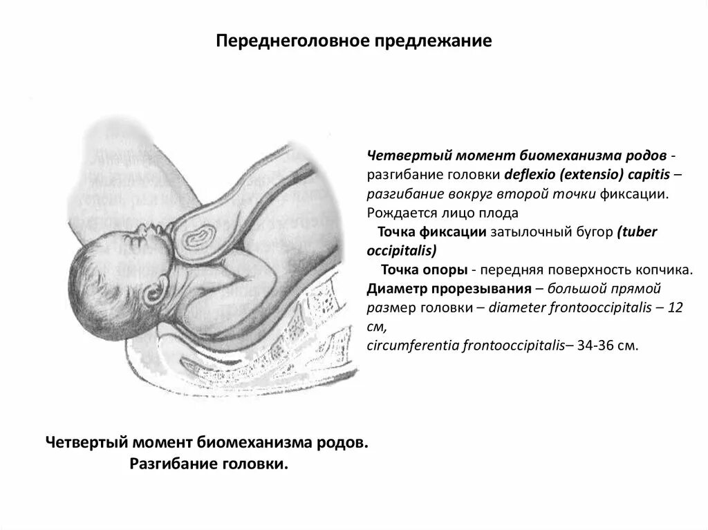 Биомеханизм родов при лобном предлежании. Лобное предлежание плода биомеханизм родов. Первый момент биомеханизма родов при переднеголовном предлежании. Переднеголовное вставление биомеханизм родов. Переднеголовное предлежание