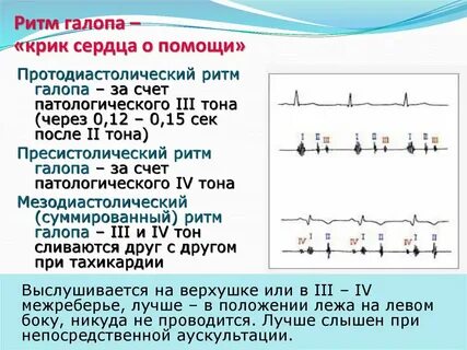 Тоны сердца ритмичные