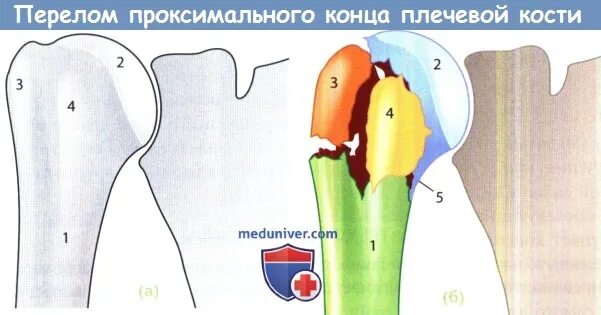 Проксимальный отдел нижних конечностей. Проксимальный сегмент бедра. Лучевая кость проксимальный эпифиз. Плечевая кость анатомия характеристика. Плечевая кость правая вид спереди и сзади.