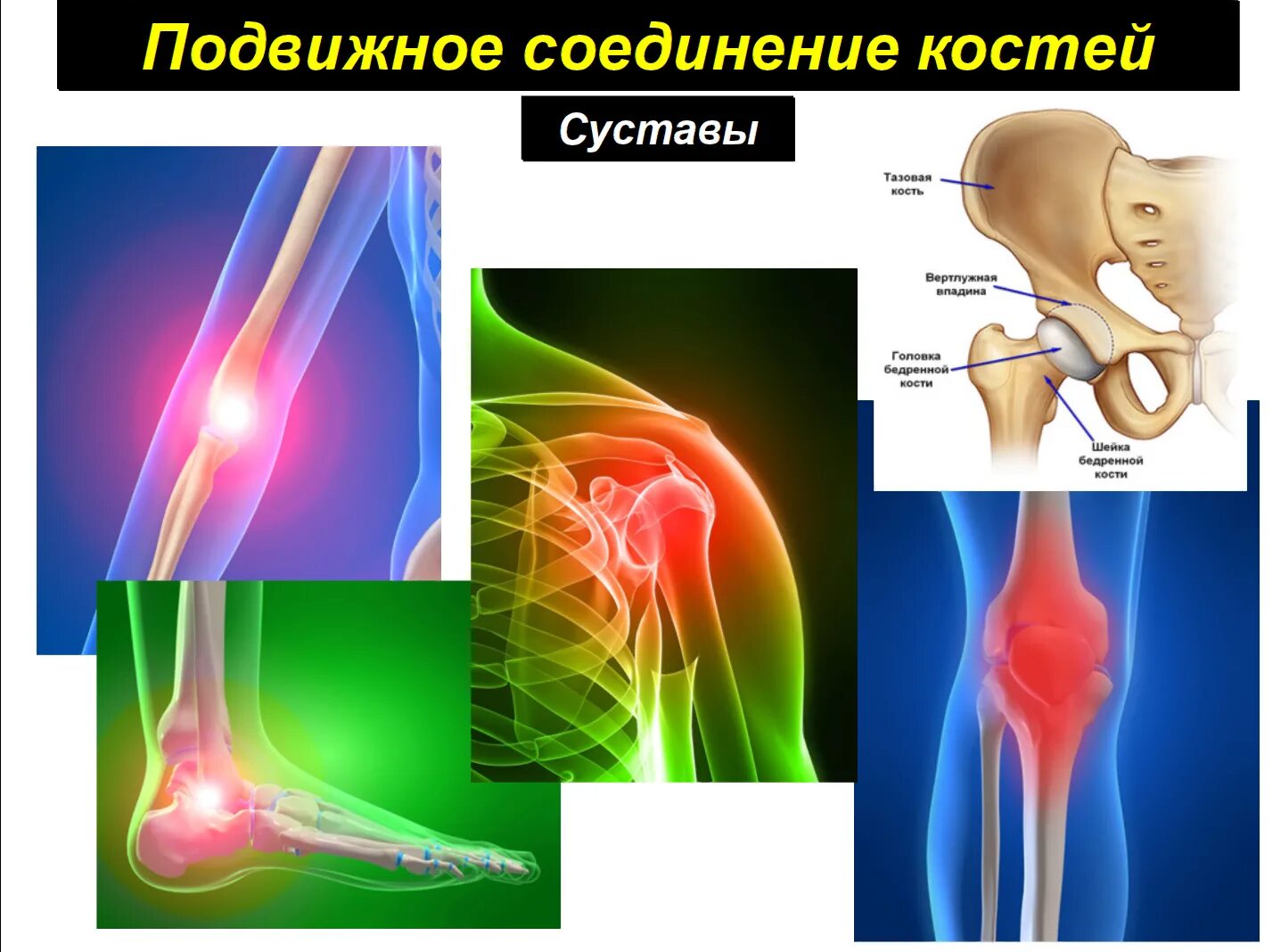 Соединение костей суставы. Кости подвижное соединение. Подвижные соединения суставы. Подвижные соединения костей.