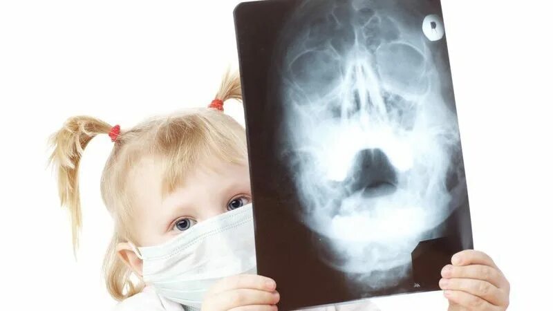 Как выглядит гайморит у детей Painful Nose Crusting in a Child Journal of Urgent Care Medicine