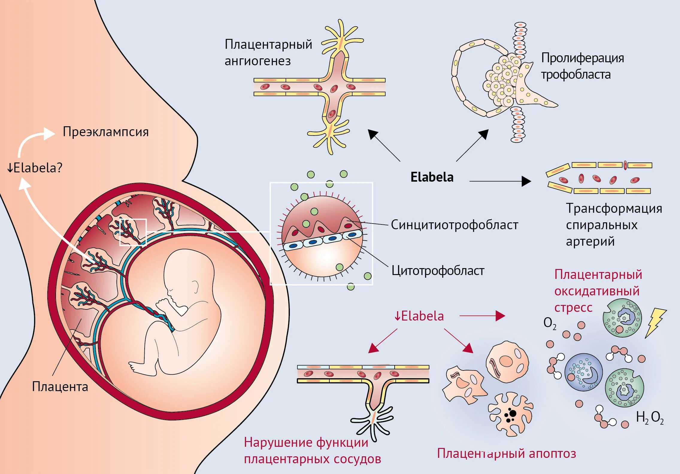 Плод человека получает кислород через. Преэклампсия патогенез схема. Эклампсия патогенез трофобласт. Трофобласта плаценты. Преэклампсия плацентарная теория.