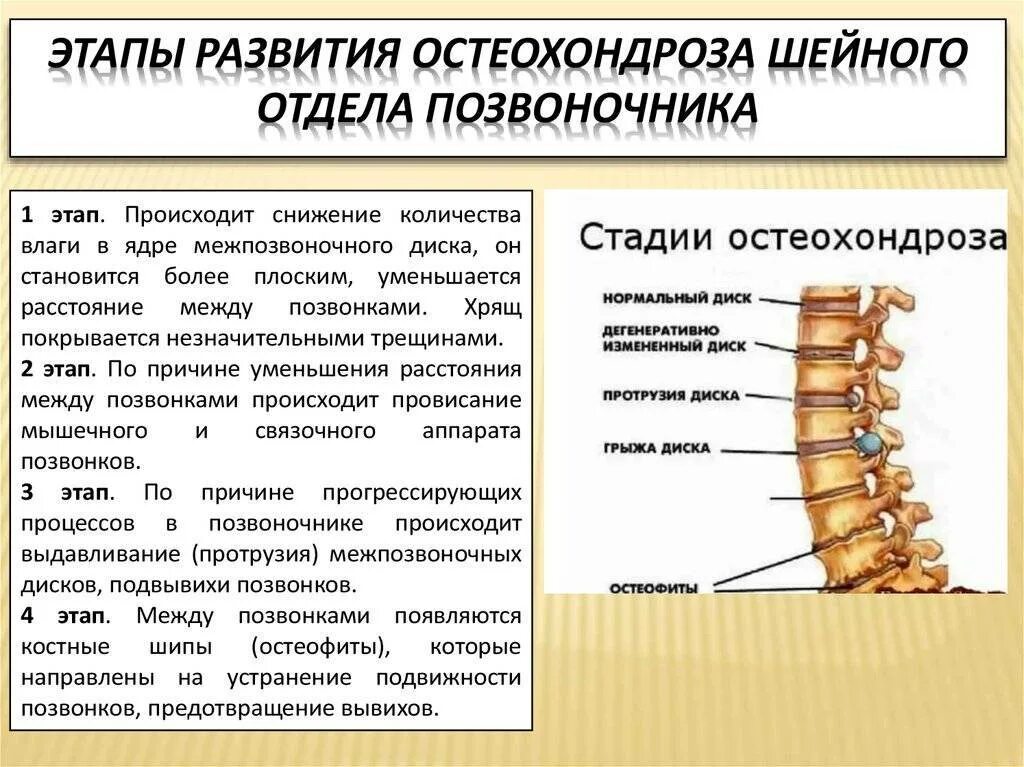 Сколько лечится позвоночник