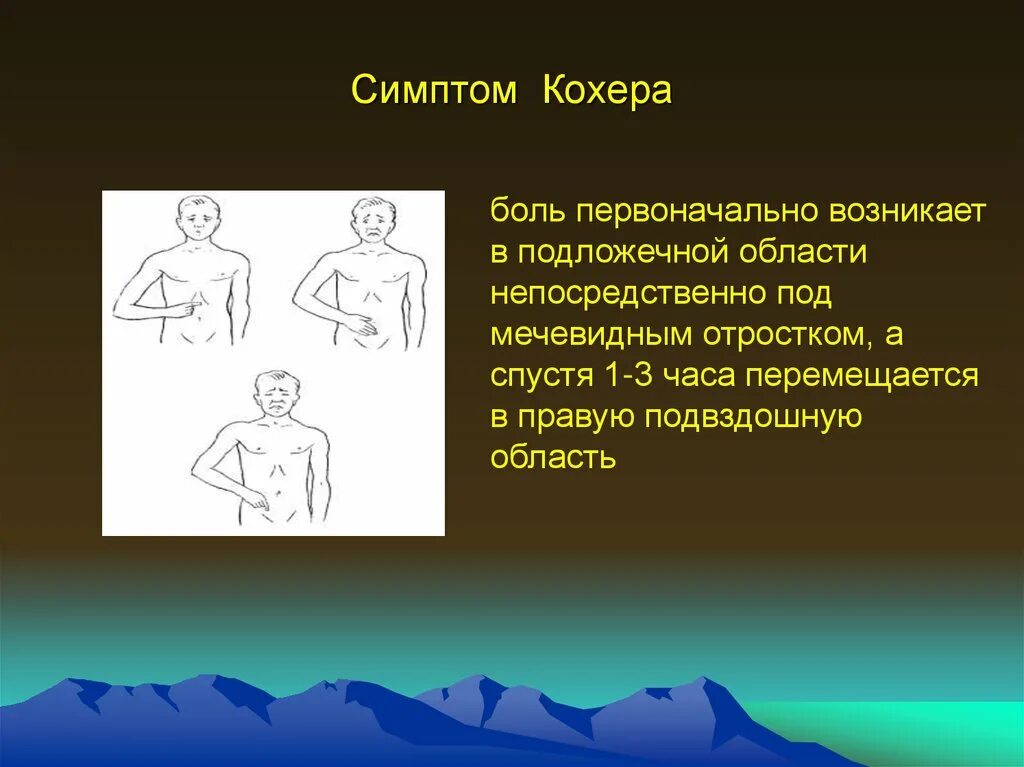 Кохер аппендицит. Симптом кохера-Волковича. Симптом кохера патогенез. Кохера Волковича патогенез.